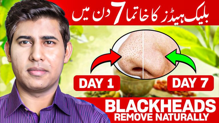 easy way naturally removing blackheads